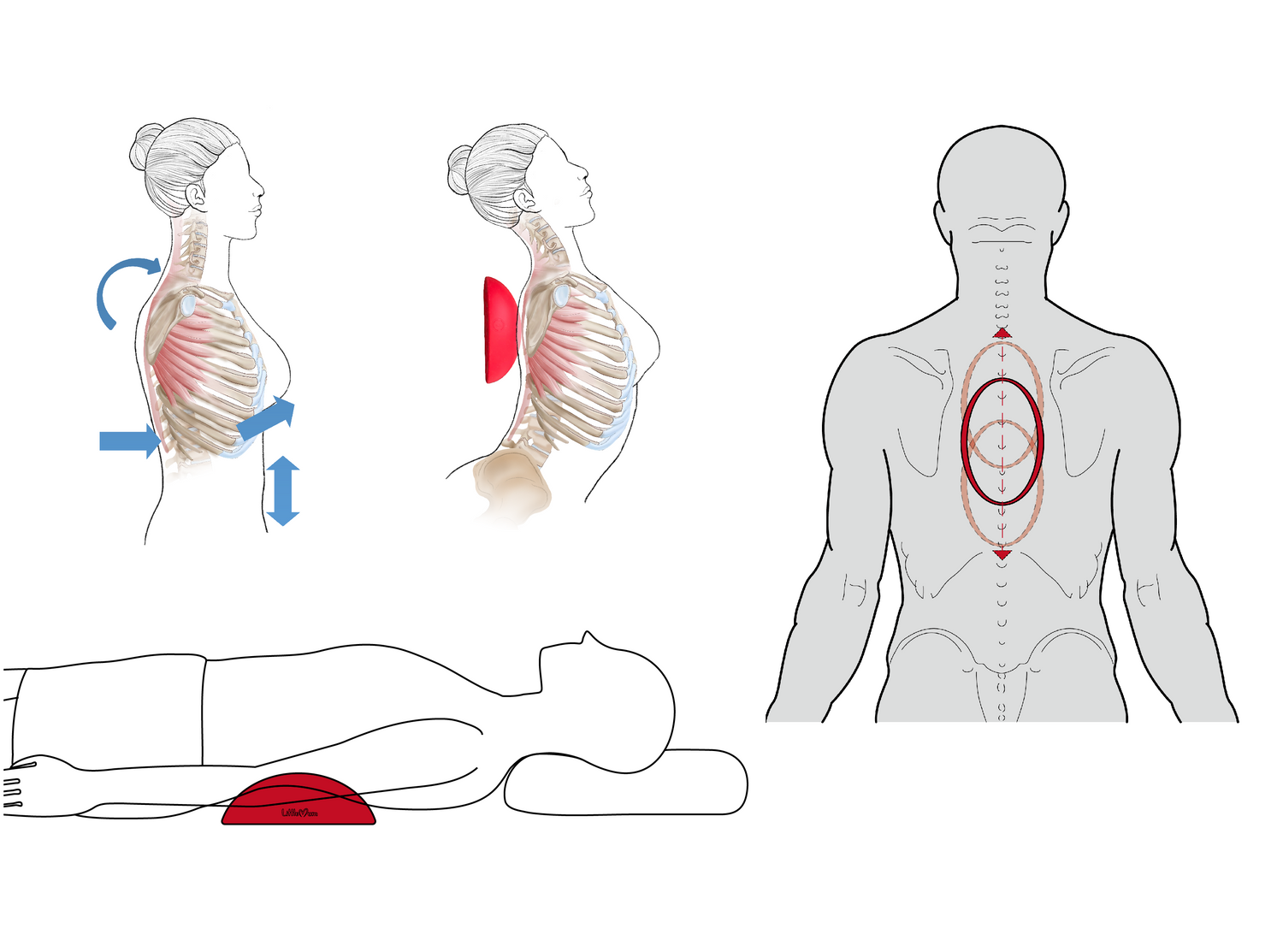 How to use a thoracic stretcher for costochondritis