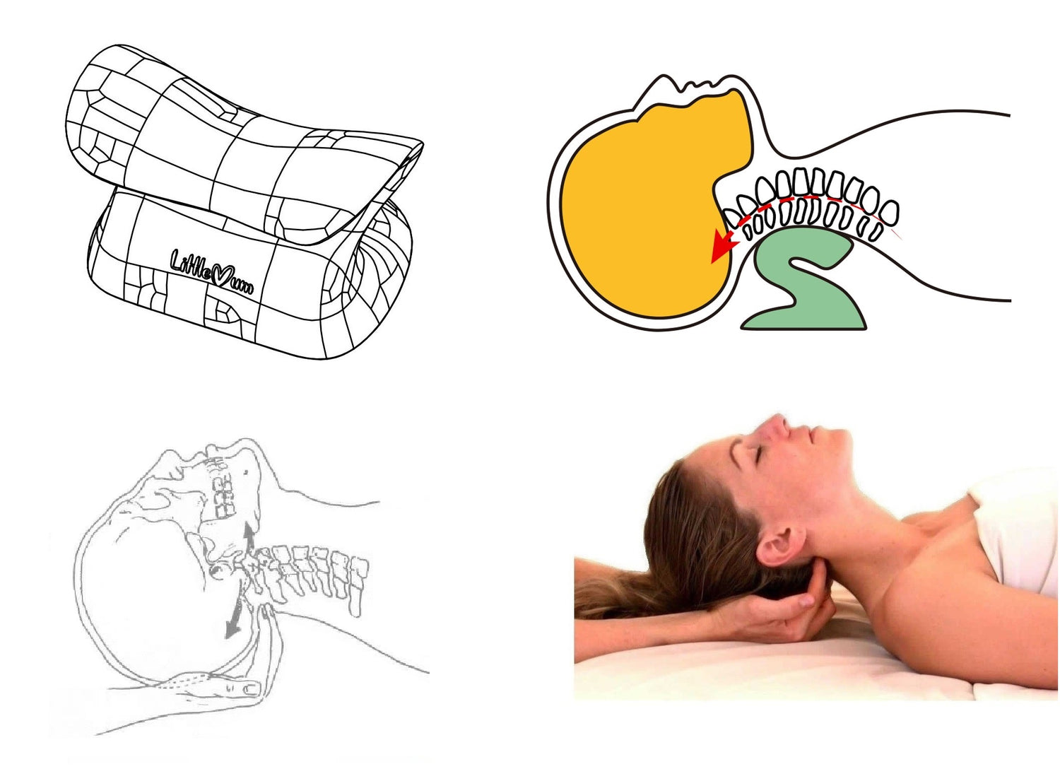 Reversible S-shaped neck support for controlled cervical extension
