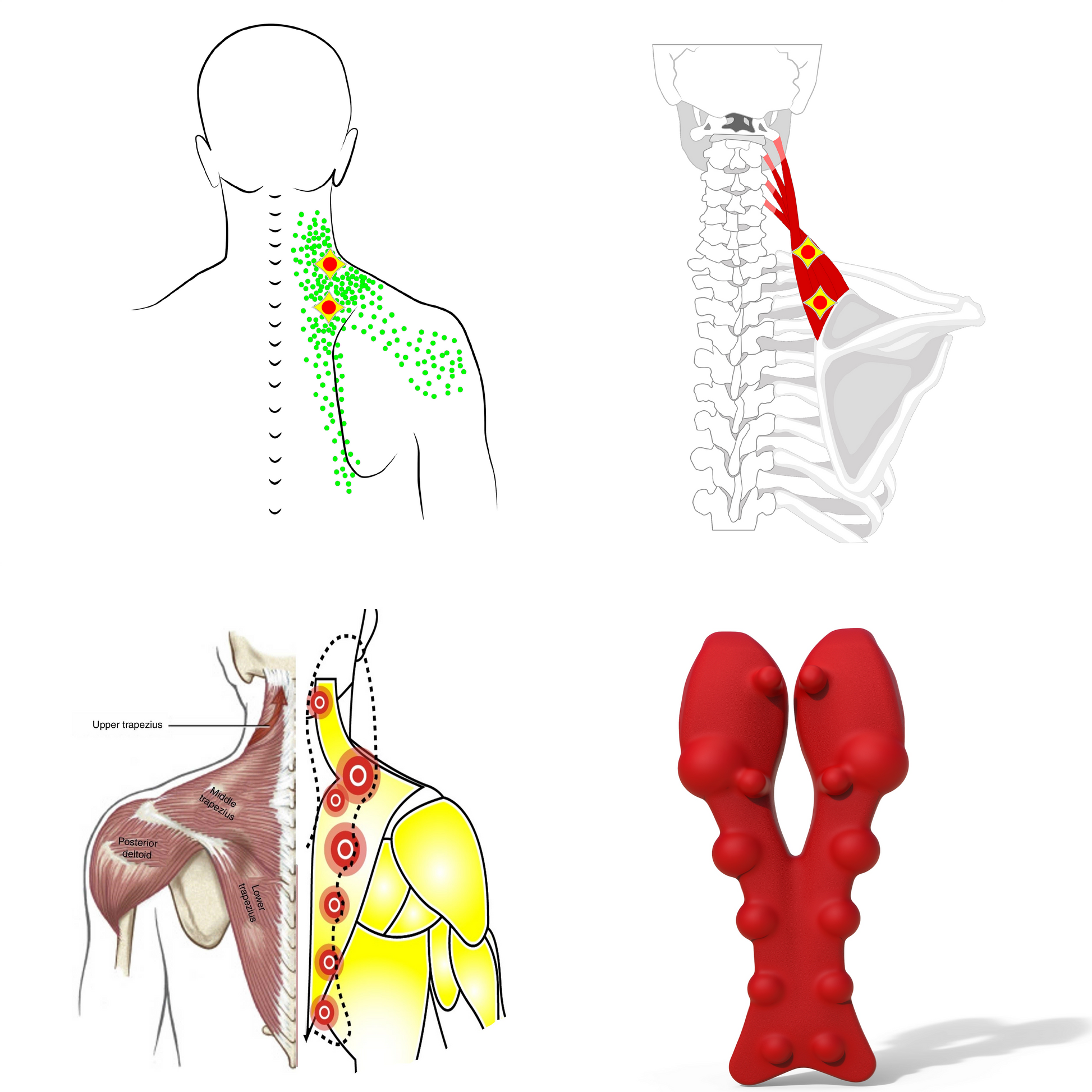 Levator scapulae trigger points and neck shoulder massage tool