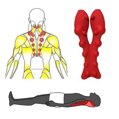 Trapezius muscle knot locations matched to pressure point nodes